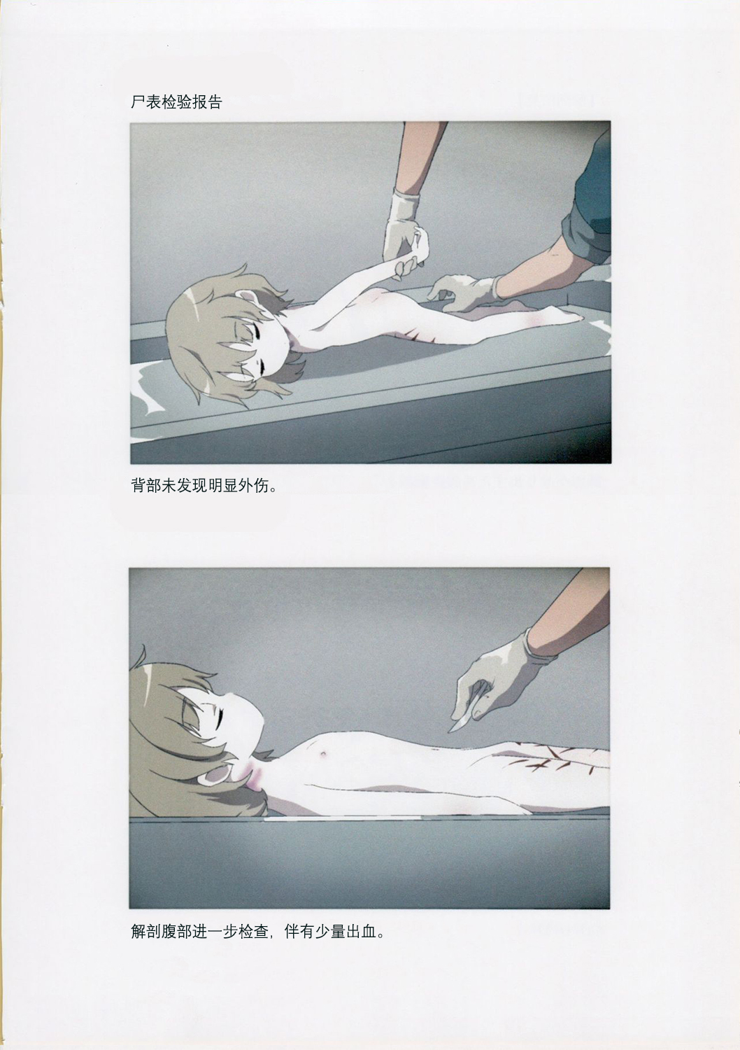 Nishiogikubo Shoujo Satsugai Jiken Shihou Kaibou Kiroku| 西荻洼少女特大谋杀案法医学尸体检验报告书 page 6 full