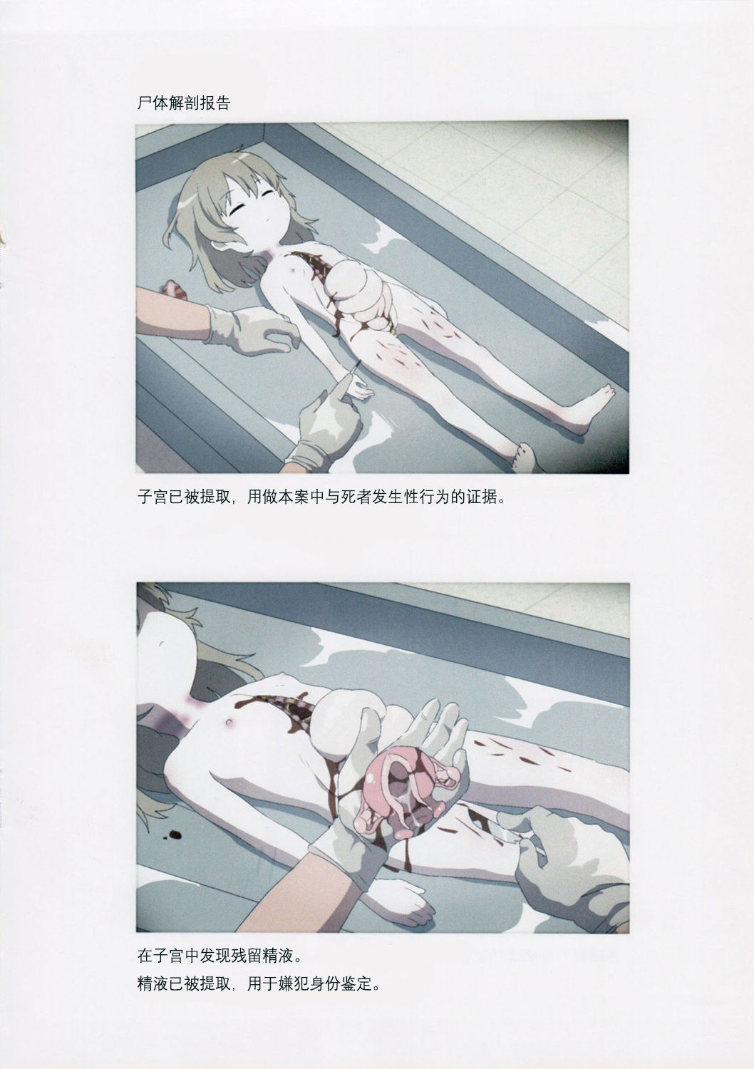 Nishiogikubo Shoujo Satsugai Jiken Shihou Kaibou Kiroku| 西荻洼少女特大谋杀案法医学尸体检验报告书 page 8 full