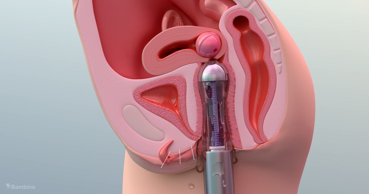 Bambina Fanbox  übersetzt 300 jen plahn page 8 full