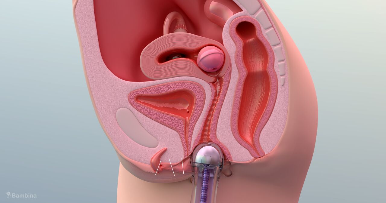 Bambina Fanbox  übersetzt 300 jen plahn page 9 full